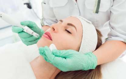 Microneedling